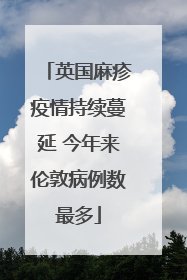 英国麻疹疫情持续蔓延 今年来伦敦病例数最多